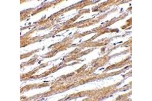 Immunohistochemistry (IHC) image for anti-CD274 (PD-L1) (Middle Region) antibody (ABIN1031034) (PD-L1 抗体  (Middle Region))