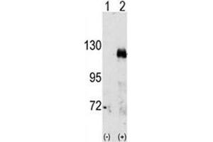 Western blot analysis of EphA3 antibody and 293 cell lysate either nontransfected (Lane 1) or transiently transfected with the EphA3 gene (2). (EPH Receptor A3 抗体  (AA 896-928))
