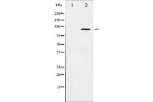 alpha Adducin 抗体  (pSer726)