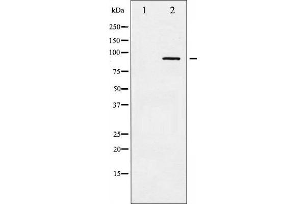 alpha Adducin 抗体  (pSer726)