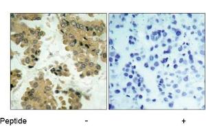Image no. 1 for anti-V-Akt Murine Thymoma Viral Oncogene Homolog 2 (AKT2) (Ser474) antibody (ABIN197358)