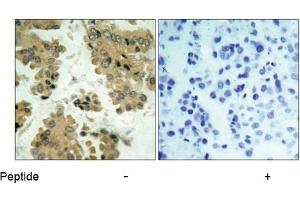 Image no. 1 for anti-V-Akt Murine Thymoma Viral Oncogene Homolog 2 (AKT2) (Ser474) antibody (ABIN197358) (AKT2 抗体  (Ser474))