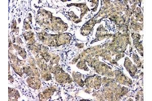 IHC analysis of EIF6 using anti-EIF6 antibody (ABIN6719594). (EIF6 抗体  (AA 66-210))