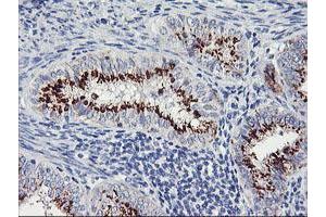 Image no. 6 for anti-Golgi Membrane Protein 1 (GOLM1) antibody (ABIN1498494) (GOLM1 抗体)