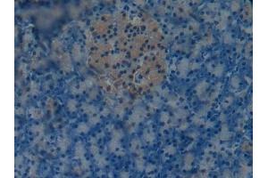 Immunohistochemistry (IHC) image for anti-Osteocalcin (BGLAP) (AA 14-95) antibody (ABIN7431830)