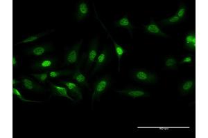 Immunofluorescence (IF) image for anti-Breakpoint Cluster Region (BCR) (AA 182-280) antibody (ABIN513693)