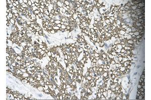 Rabbit Anti-MORF4L1 Antibody       Paraffin Embedded Tissue:  Human cardiac cell   Cellular Data:  Epithelial cells of renal tubule  Antibody Concentration:   4.