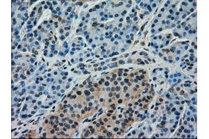 Immunohistochemical staining of paraffin-embedded pancreas tissue using anti-FERMT2mouse monoclonal antibody. (FERMT2 抗体)