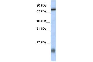 WB Suggested Anti-C21orf13 Antibody Titration:  0. (LCA5L 抗体  (N-Term))