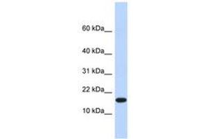 Image no. 1 for anti-Egl-9 Family Hypoxia Inducible Factor 2 (EGLN2) (AA 281-315) antibody (ABIN6740396) (PHD1 抗体  (AA 281-315))