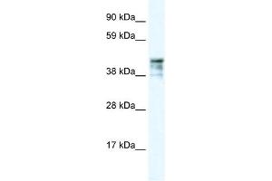 KRT15 antibody (70R-10423) used at 2. (KRT15 抗体  (C-Term))