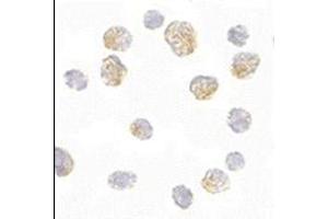 Immunocytochemistry of Slc35D1 in Daudi cells with this product at 5 μg/ml.