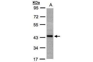 WB Image Sample(30 ug whole cell lysate) A:H1299 10% SDS PAGE antibody diluted at 1:1000 (ST3GAL2 抗体)