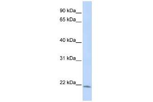 LIN7C antibody used at 1 ug/ml to detect target protein. (LIN7C 抗体)