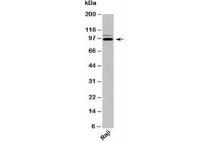 Western blot testing of human samples with TRIL antibody at 2ug/ml. (TRIL 抗体  (C-Term))