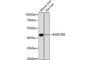 Western blot analysis of extracts of various cell lines, using HSD17B2 antibody (ABIN3015794, ABIN3015795, ABIN3015796 and ABIN6219142) at 1:1000 dilution. (HSD17B2 抗体  (AA 118-387))