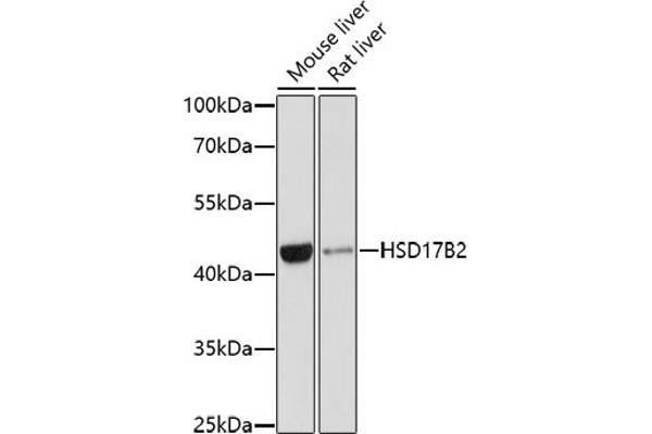 HSD17B2 抗体  (AA 118-387)