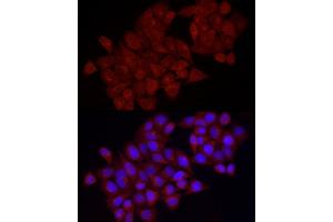 Immunofluorescence analysis of HeLa cells using VEGFA Rabbit pAb (ABIN6128908, ABIN6150086, ABIN6150088 and ABIN6221373) at dilution of 1:100 (40x lens).