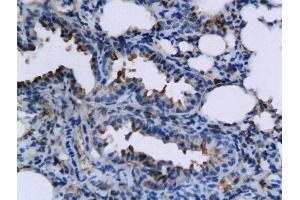 Formalin-fixed and paraffin embedded mouse lung labeled with Rabbit Anti-TNFSF15 Polyclonal Antibody, Unconjugated  followed by conjugation to the secondary antibody and DAB staining (TNFSF15 抗体  (AA 161-251))