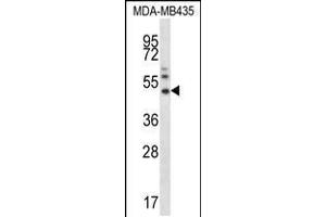 Western blot analysis in MDA-MB435 cell line lysates (35ug/lane). (MMP16 抗体  (N-Term))