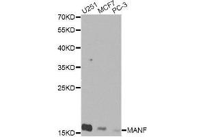 Western blot analysis of extracts of various cell lines, using MANF Antibody. (MANF 抗体  (AA 25-182))