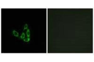 Immunofluorescence analysis of A549 cells, using GCNT3 antibody. (GCNT3 抗体)