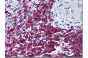 Immunohistochemistry (IHC) image for anti-CD247 Molecule (CD247) (AA 1-165) antibody (ABIN782349) (CD247 抗体  (AA 1-165))
