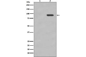 Western blot analysis of Phospho-beta Catenin (S33/S37) expression in (1) 293T cell lysate, (2) 293T cell lysate treated with calyculin A.