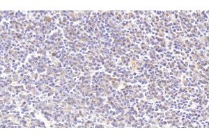 Detection of C3a in Human Spleen Tissue using Polyclonal Antibody to Complement Component 3a (C3a) (C3a 抗体  (AA 672-748))
