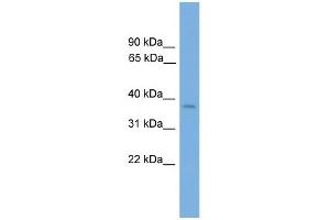 WB Suggested Anti-Six3 Antibody Titration:  0.