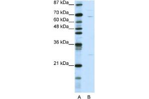 WB Suggested Anti-KLHL13 Antibody Titration:  0. (KLHL13 抗体  (N-Term))
