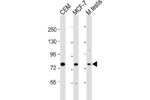 All lanes : Anti-MYBL2 Antibody (C-Term) at 1:8000 dilution Lane 1: CEM whole cell lysate Lane 2: MCF-7 whole cell lysate Lane 3: mouse testis lysate Lysates/proteins at 20 μg per lane. (MYBL2 抗体  (AA 540-571))