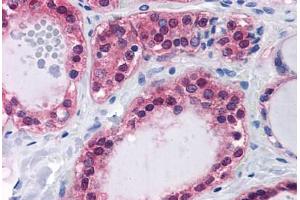 Human Thyroid: Formalin-Fixed, Paraffin-Embedded (FFPE) (SDSL 抗体  (AA 1-330))