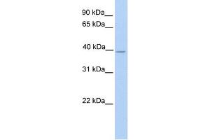 NEK6 antibody used at 1 ug/ml to detect target protein. (NEK6 抗体)