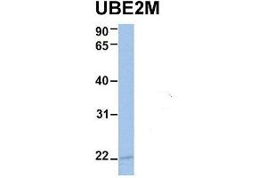Host:  Rabbit  Target Name:  UBE2M  Sample Type:  Human MCF7  Antibody Dilution:  1. (UBE2M 抗体  (N-Term))
