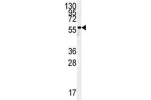 Western Blotting (WB) image for anti-Pyruvate Kinase M2 (PKM2) (AA 476-505) antibody (ABIN3032237)