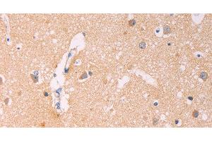 Immunohistochemistry of paraffin-embedded Human brain using ADCY1 Polyclonal Antibody at dilution of 1:60 (ADCY1 抗体)