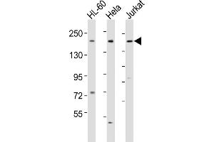All lanes : Anti-DIP2A Antibody (Center) at 1:1000-1:2000 dilution Lane 1: HL-60 whole cell lysates Lane 2: Hela whole cell lysates Lane 3: Jurkat whole cell lysates Lysates/proteins at 20 μg per lane. (DIP2A 抗体  (AA 934-969))
