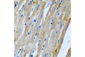 Immunohistochemical analysis of Fis1 staining in rat heart formalin fixed paraffin embedded tissue section. (Fission 1 抗体)