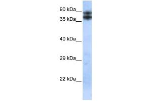 WB Suggested Anti-LIMA1 Antibody Titration:  0. (LIMA1 抗体  (N-Term))