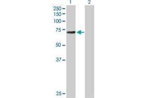 Western Blot analysis of ALOX12 expression in transfected 293T cell line by ALOX12 MaxPab polyclonal antibody. (ALOX12 抗体  (AA 1-663))