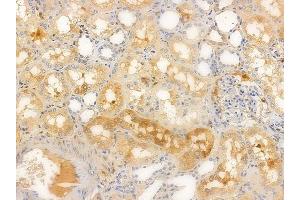 ABIN6256394 and ABIN6267617 at 1/100 staining human normal kidney tissue by IHC-P. (PKC delta 抗体  (pSer645))