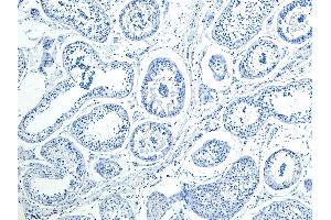 ABIN1590026 Negative Control showing staining of paraffin embedded Human Testis, with no primary antibody. (HOXA10 抗体  (Internal Region))