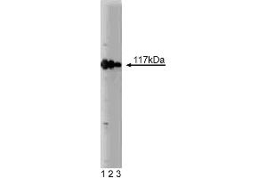 Western blot analysis of rabaptin-5 on a MCF-7 lysate. (RABEP1 抗体  (AA 247-417))