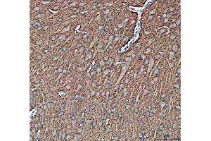 IHC analysis of Synapsin II using anti-Synapsin II antibody (ABIN4886735). (SYN2 抗体  (AA 497-582))
