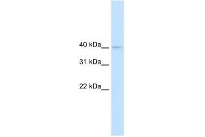 NUDT9 antibody used at 0. (NUDT9 抗体)