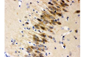 Immunohistochemistry (IHC) image for anti-Otoferlin (OTOF) (AA 1831-1863), (C-Term) antibody (ABIN3042499)