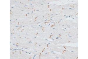 Immunohistochemistry of paraffin-embedded Rat heart using N-Cadherin Polyclonal Antibody at dilution of 1:100 (40x lens). (N-Cadherin 抗体)