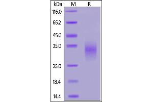 SDS-PAGE (SDS) image for Killer Cell Lectin-Like Receptor Subfamily K, Member 1 (KLRK1) (AA 73-216) (Active) protein (His tag) (ABIN7013383)