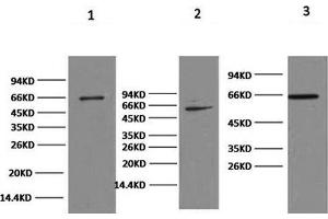 Western Blot analysis of 1) Hela, 2) 293T, 3) HepG2 cells using NFκB-p65 Monoclonal Antibody at dilution of 1:2000. (NF-kB p65 抗体)